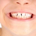 Xylitol for child&#39;s dental health
