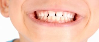 Xylitol for child&#39;s dental health