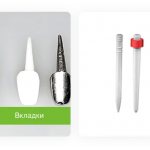 core inlays and dental pins