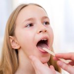 treatment of chronic tonsillitis