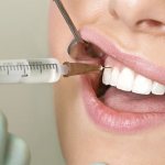 dental treatment for a nursing mother