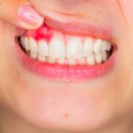 Dental treatment in Ufa