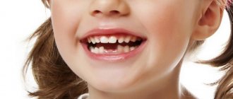 Do molars change in children?