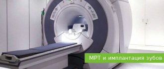 MRI and dental implantation