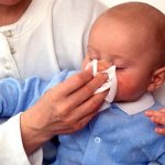 Runny nose in infants is a common disease