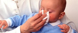 Runny nose in infants is a common disease