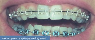 uneven front teeth.jpg