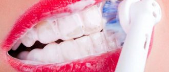 assessment of the hygienic condition of the oral cavity