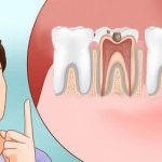 Acute toothache. What to do if your tooth hurts 