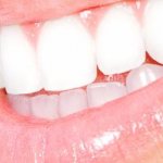 Teeth whitening Opalescence (Opalescence)