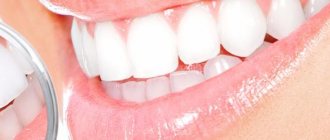 Отбеливание зубов Opalescence (Опалесценс)