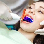 Teeth whitening with ultraviolet light