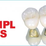 Expert reviews about Simpl Swiss implants