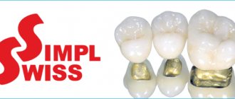 Expert reviews about Simpl Swiss implants