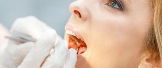 Why does a dead tooth hurt?