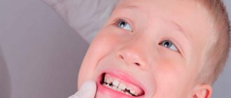 A child’s permanent bite is formed by the age of 12-13 years.