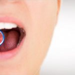 Пробиотики для восстановления микрофлоры полости рта и лечения воспалений тканей