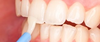 Teeth fluoridation procedure