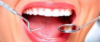 Разница удаления верхних и нижних зубов