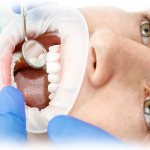 destruction of tooth enamel