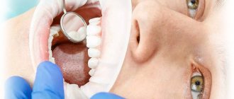 destruction of tooth enamel