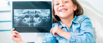 Рентген при стоматологическом лечении