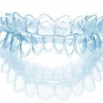 How much do clear aligners cost?