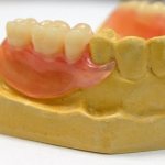 Timing and stages of manufacturing a removable denture