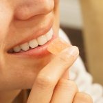 стоит ли делать отбеливание зубов