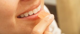 Is teeth whitening worth it?