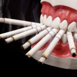 Табачный дым препятствует заживлению лунки после экстракции