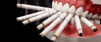 Табачный дым препятствует заживлению лунки после экстракции