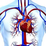 severe diseases of the cardiovascular system