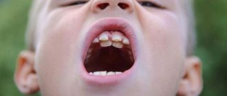 Children have shark teeth, what is dangerous or not to do?