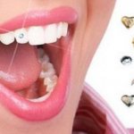 Installing rhinestones on a tooth