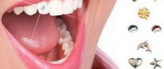 Installing rhinestones on a tooth