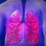 УЗИ - способ диагностика туберкулёза