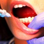 Is it possible to have dental prosthetics during pregnancy?