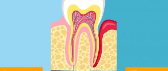 Healthy tooth and periodontitis in pictures
