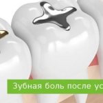 зубная боль после установки пломбы